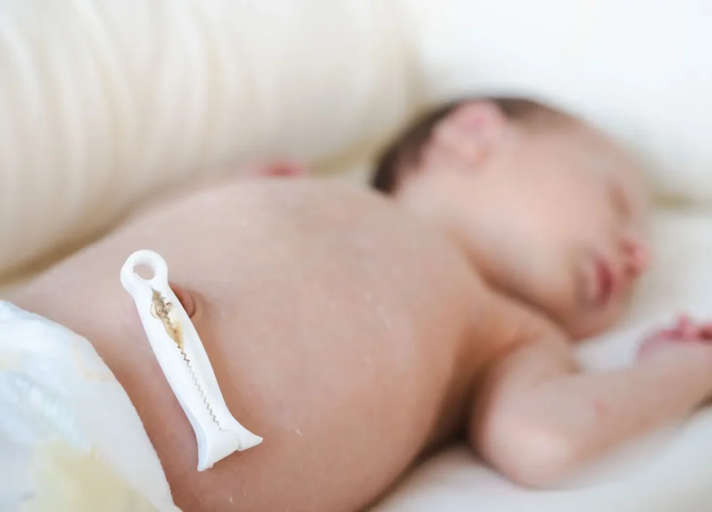 newborn-umbilical-cord